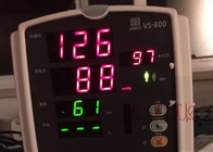 VS800 RESP NIBP SPO2 использовало монитор Mindray терпеливого монитора сердечный
