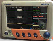Goldway UT4000Apro использовало терпеливый монитор с 12,1 дисплеем дюйма TFT