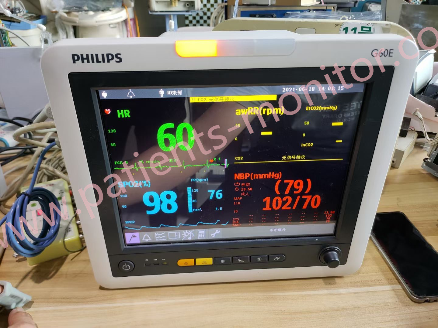 Монитор Philip G60E ICU терпеливый для клиники больницы